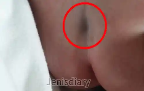 신생아 엉덩이 딤플 이미지 02