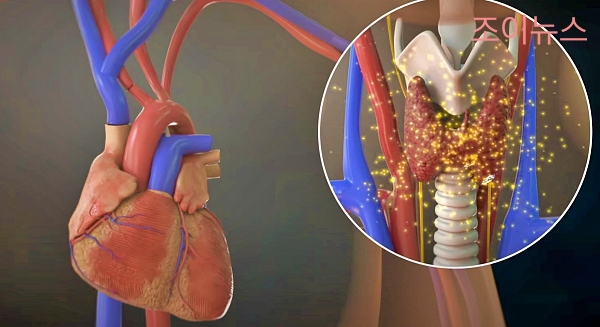 갑상선 호르몬 과다 분비로 인한 심장의 빈맥_출처: EBS 다큐 유튜브
