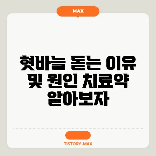 혓바늘 돋는 이유 및 원인 치료약 알아보자