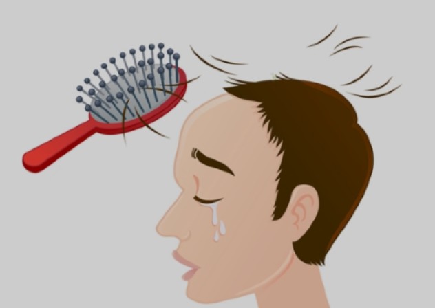 탈모 이미지