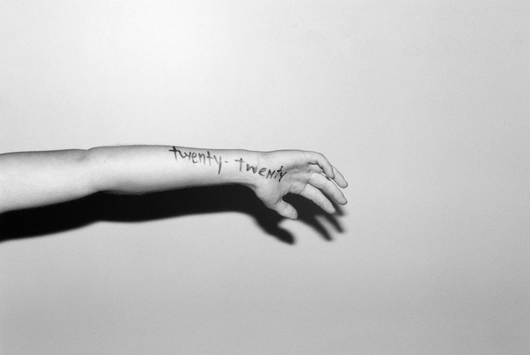 Arm