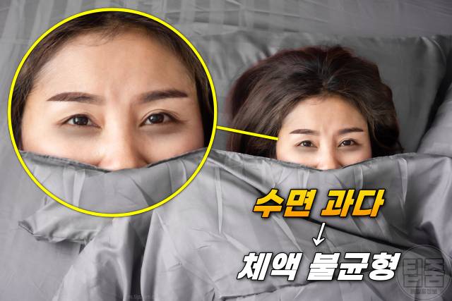 다크서클 원인 아이크림 추천 눈밑처짐 눈밑지방