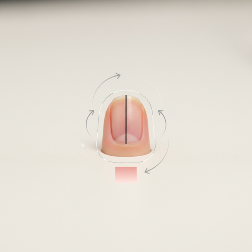 흑색종 자가진단법: 이럴 땐 꼭 병원으로!