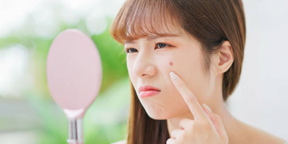 여드름