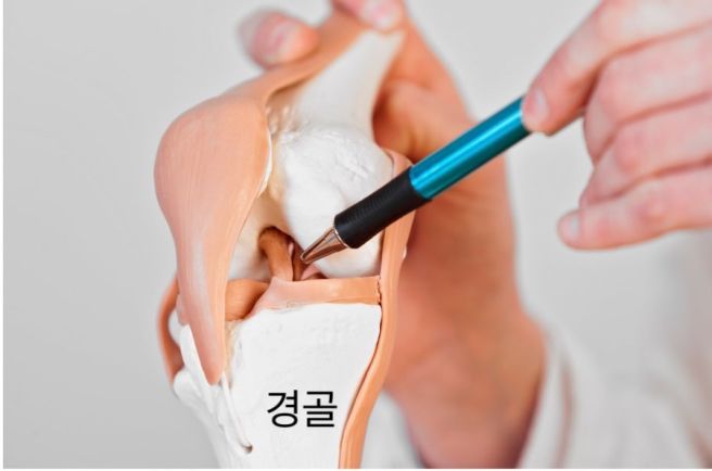 무릎에서 뚝뚝 소리가 나요