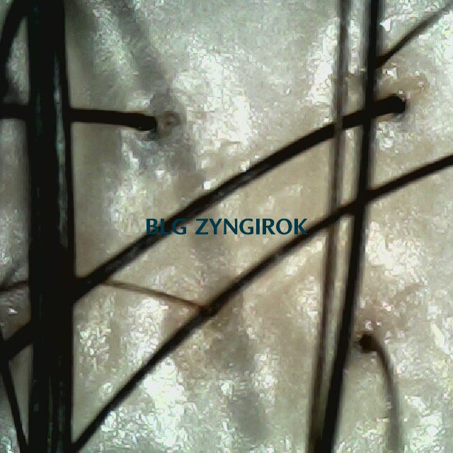 탈모 극복 프로젝트 - 정수리와 이마 사이 두피 모습이다.