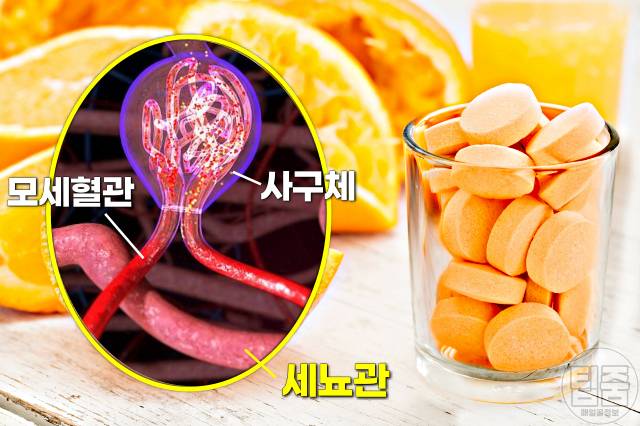 신장에 나쁜 영양제 약 비타민C 하루권장량