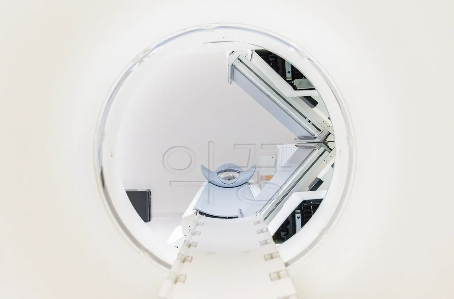 뮤코리피드증 질환 진단 MRI 사진