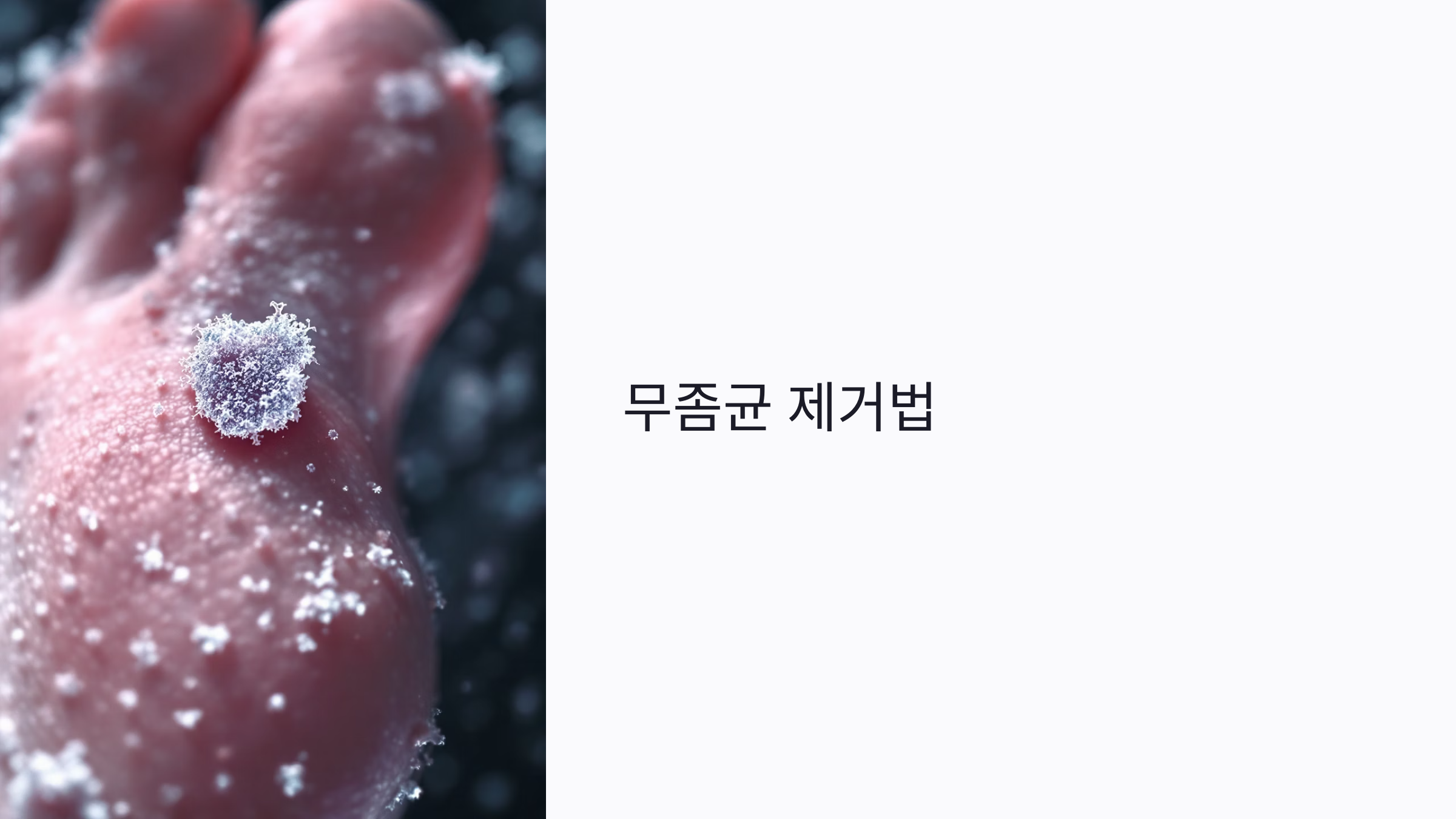 무좀균, 양말과 신발에서 살아남는다? 치료를 방해하는 생활 속 무좀균 제거법