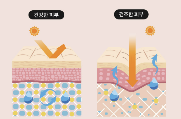 피부건조증 증상, 치료법, 좋은 음식과 연고 등 소개