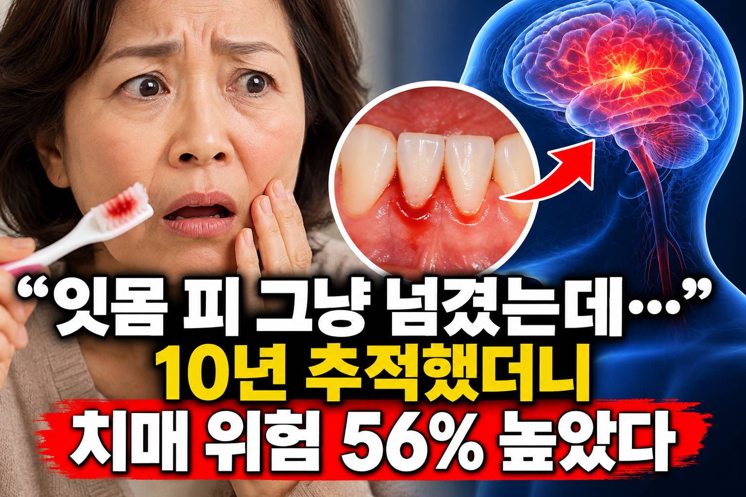 잇몸 출혈과 치매 위험의 연관성을 보여주는 치아와 뇌 모습