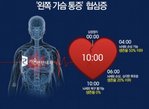 왼쪽 가슴 통증 의심되는병