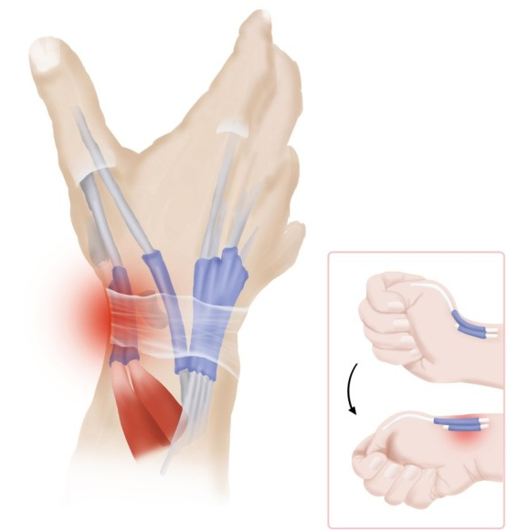 엄지 손가락 통증 원인 알아보자