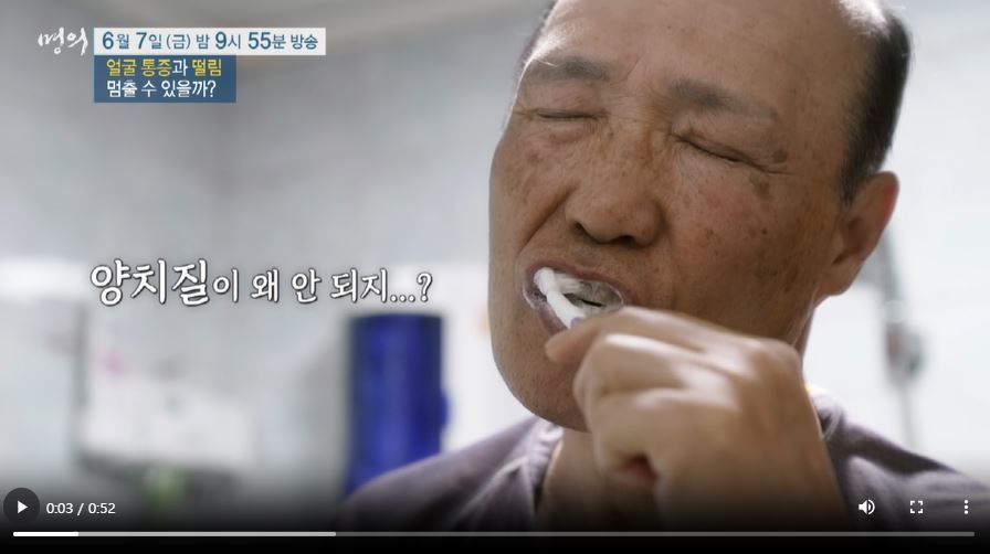 EBS 명의 삼차신경통 원인 증상 치료