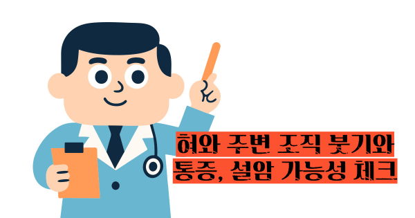 설암 초기증상