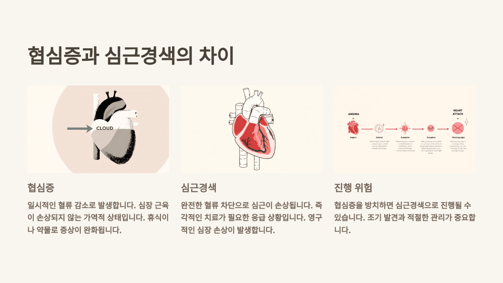 협심증과 심근경색의 차이