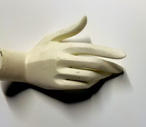 류마티스 관절염 초기증상 치료 원인 예방법