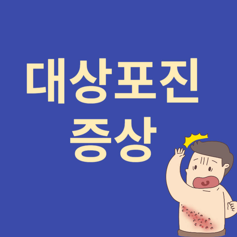 대상포진 증상