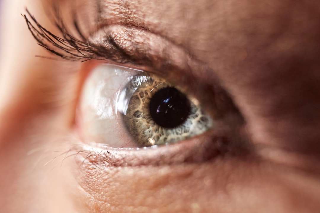 Eyelid