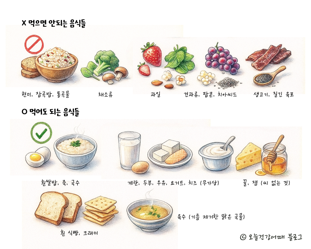 장내시경식단, 장내시경음식, 장내시경먹어도되는음식, 장내시경전음식, 장내시경전식사, 장내시경전식단
