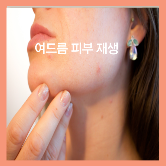 비판텐 연고