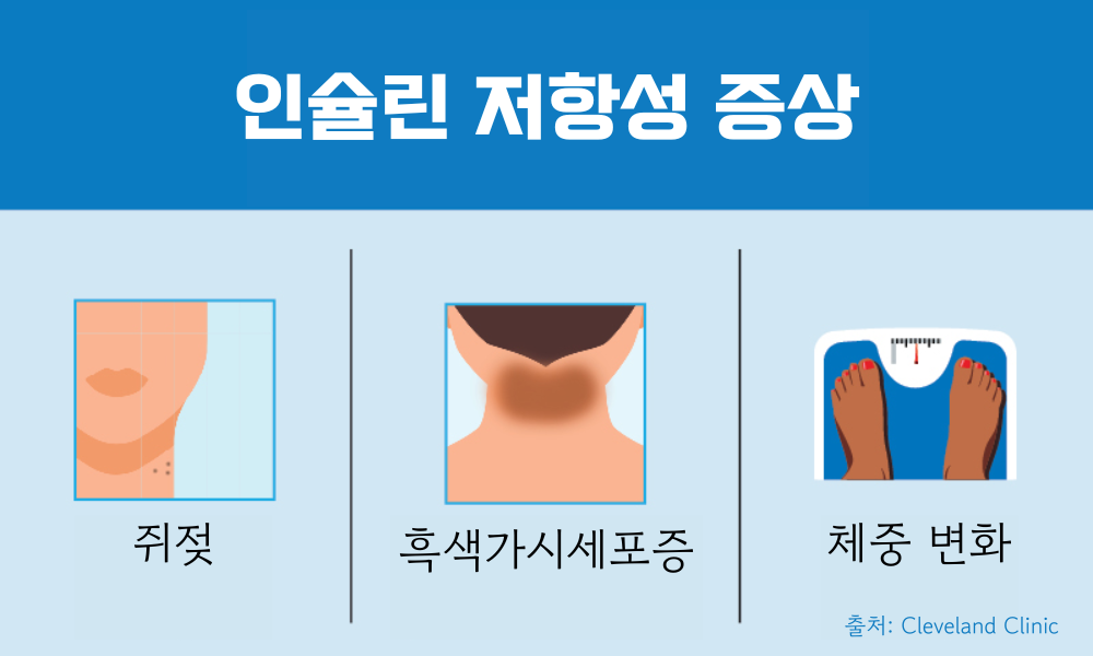 인슐린 저항성 증상