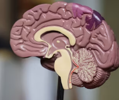 치매 진단 방법 치료 예방 가이드