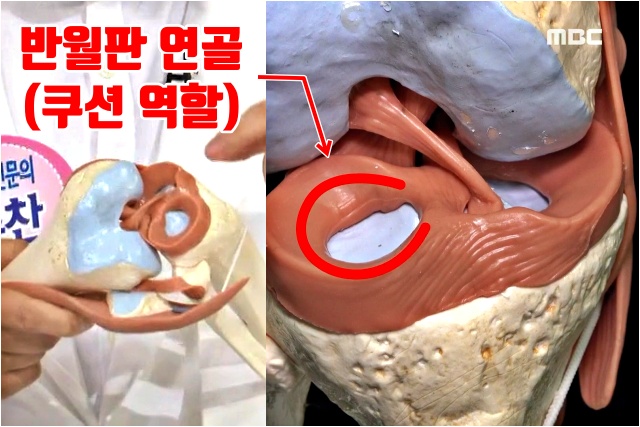 반월판 연골, 무릎에서 뚝뚝 소리 나는 이유, 앉았다 일어나면 무릎에서 소리가 나요, 무릎에서 소리나고 통증, 건강 팁줌 매일꿀정보