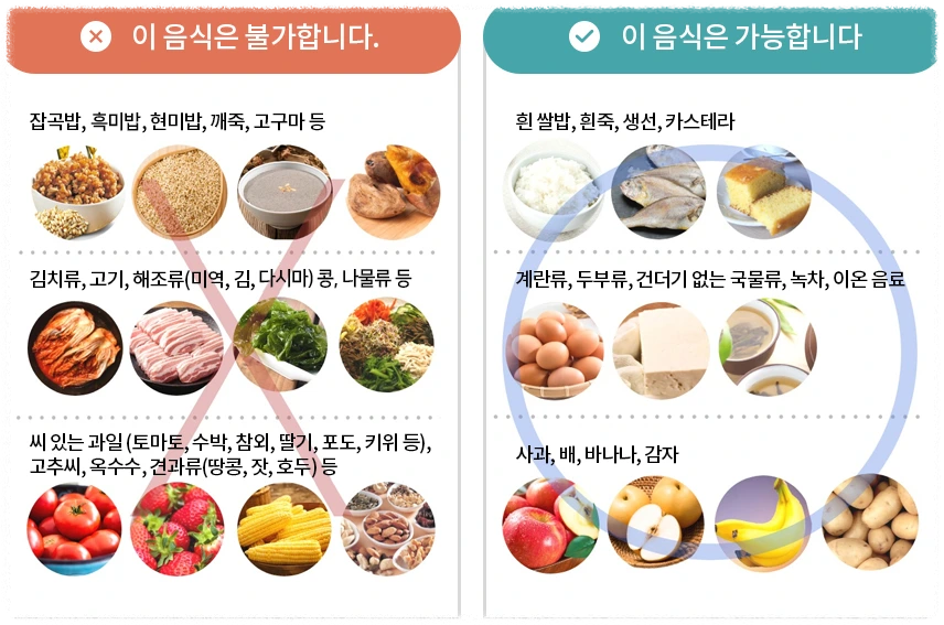 대장내시경 전 먹어도 되는 음식 안내 이미지