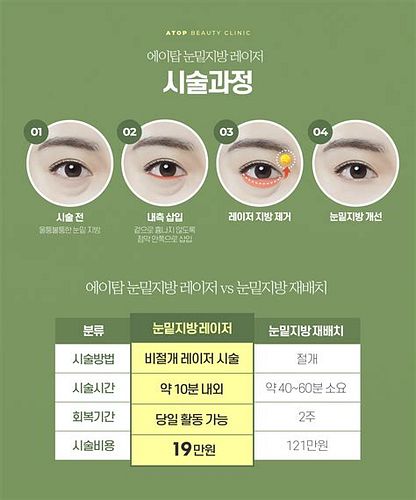 눈밑레이저