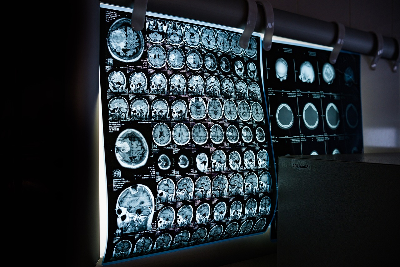 MRI 스켄 사진