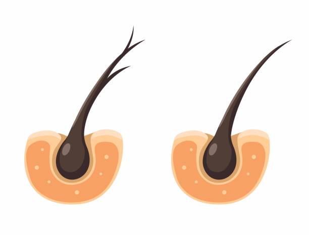 모발이 가늘어지는 주요 원인