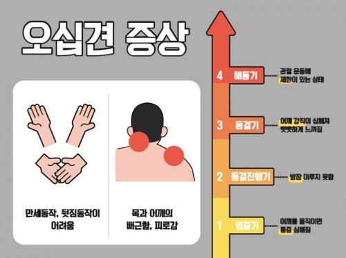 오십견