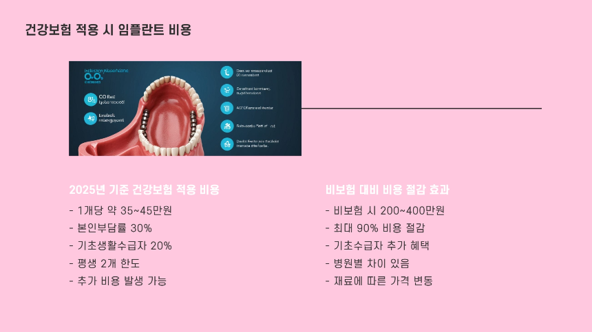 2025년 임플란트 건강보험 적용 기준 &ndash; 비용 절감할 수 있는 방법 총정리!