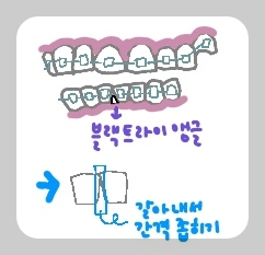 블랙트라이 앵글 그림설명