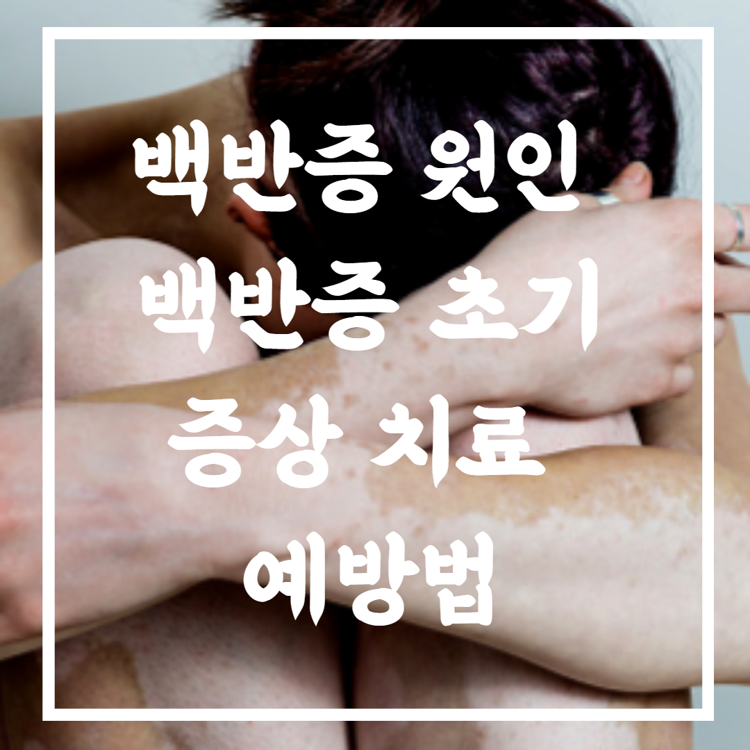 백반증초기증상