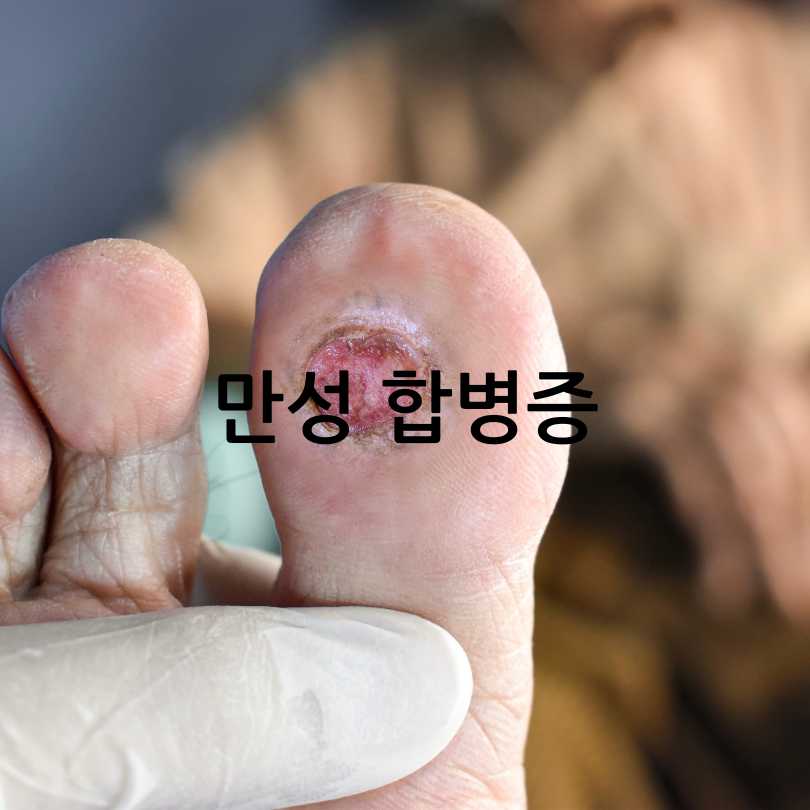 당뇨병 합병증 종류와 증상