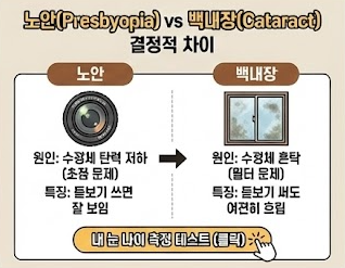 노안 vs 백내장 차이점