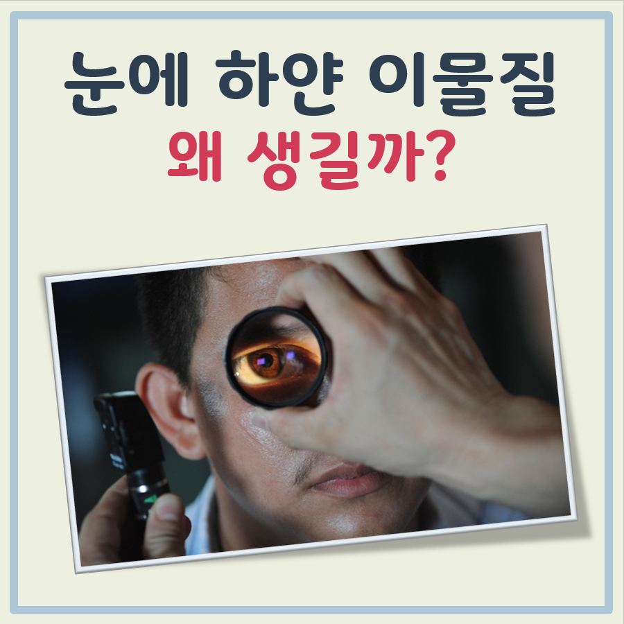 눈에 하얀 이물질 대표 이미지
