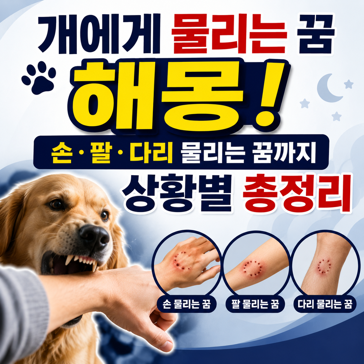 개에게 물리는 꿈