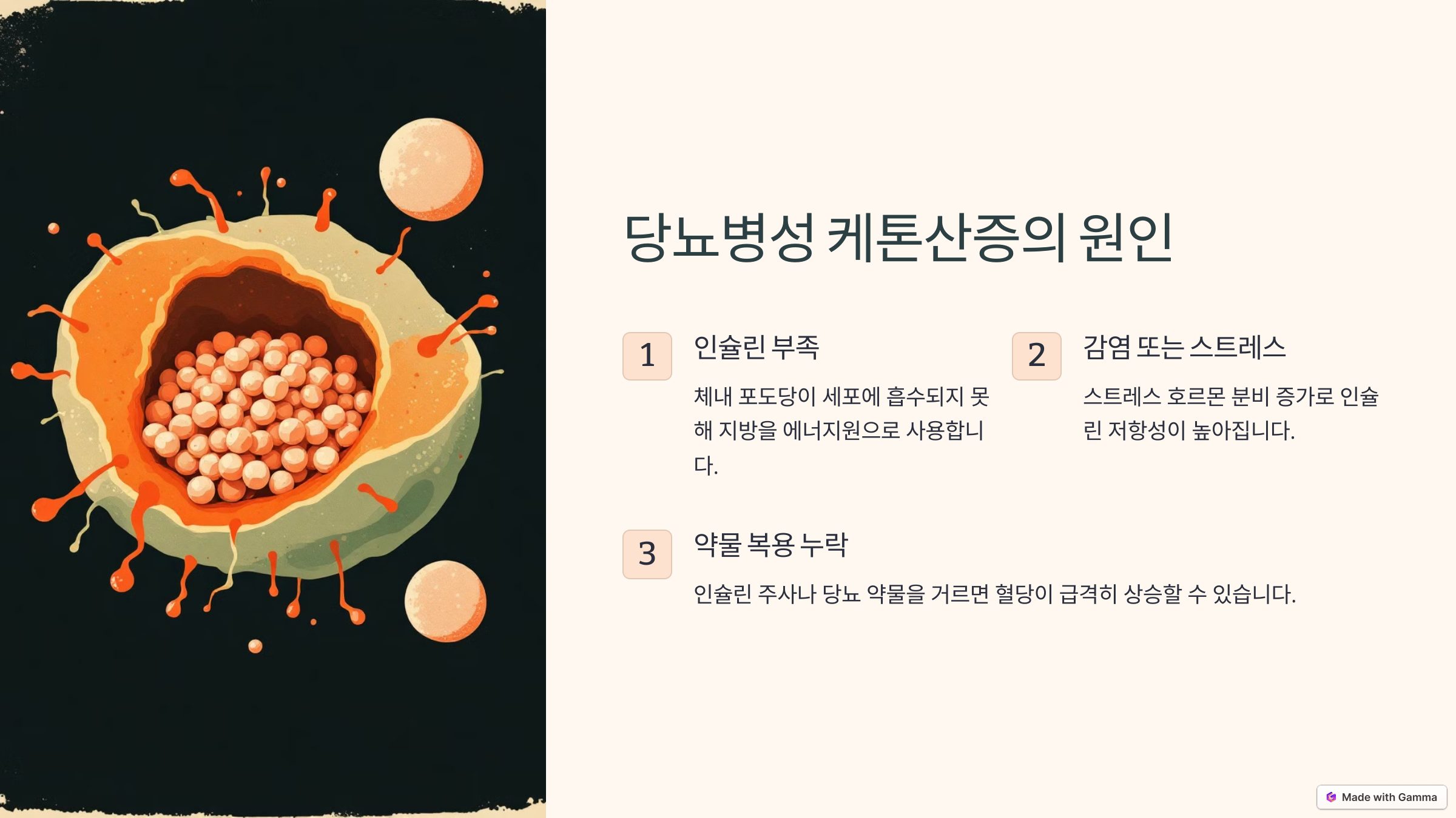 당뇨병성 케톤산증