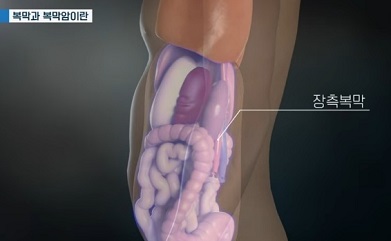 장측복막