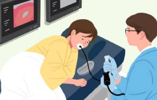 위 내시경 이미지