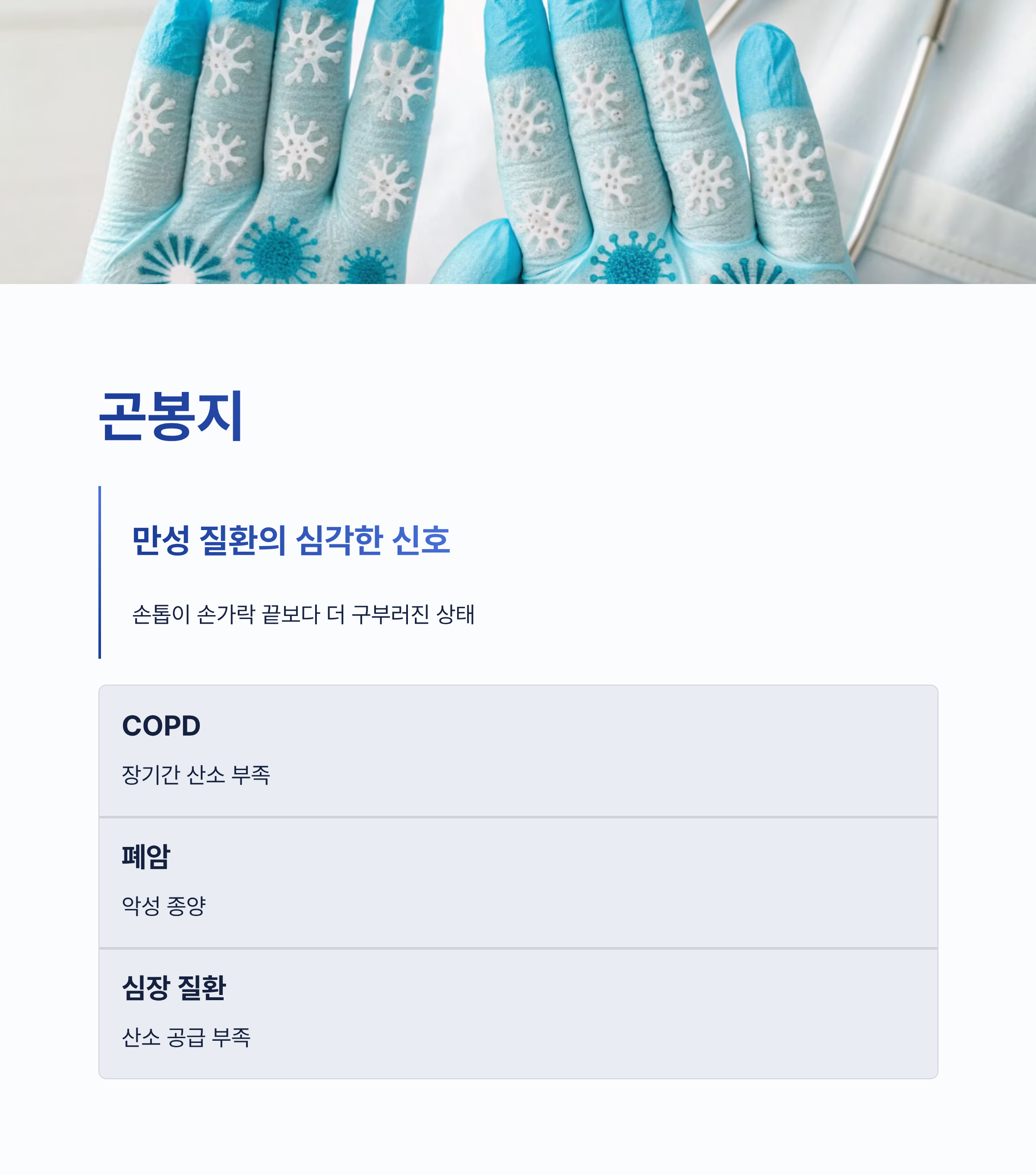 손톱으로 보는 건강상태 ❘ 손톱 색깔&middot;모양이 보내는 신체 질환 신호를 놓치면 안 되는 이유