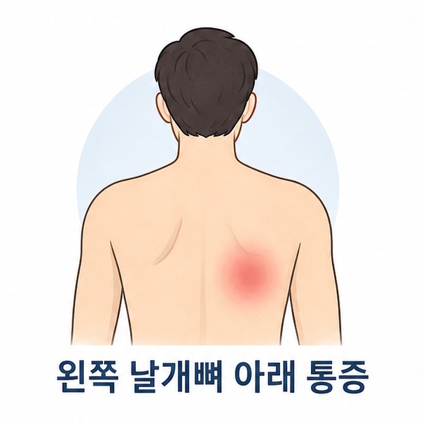 대표 이미지