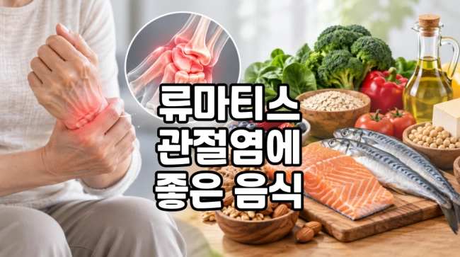 류마티스 관절염 증상에 좋은 음식