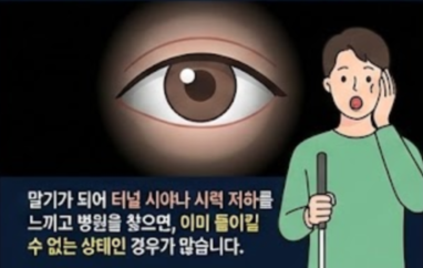 녹내장 초기증상