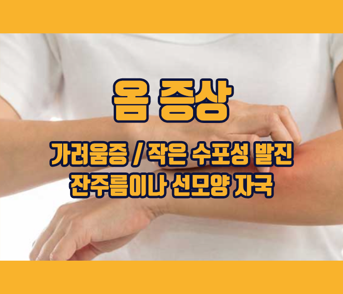 옴 증상 - 가려움증, 작은 수포성 발진, 잔주름이나 선모양 자국