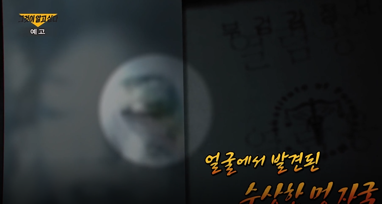 의문의 멍자국
