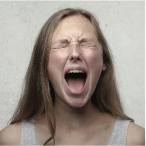 쇼그렌증후군 관련 사진